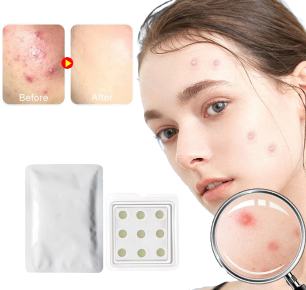 Microneedles Hyaluronic Acid Acne Patch Invisible Beauty Concealer Breathable Facial Care Mild and Non Irritating Clean Pores